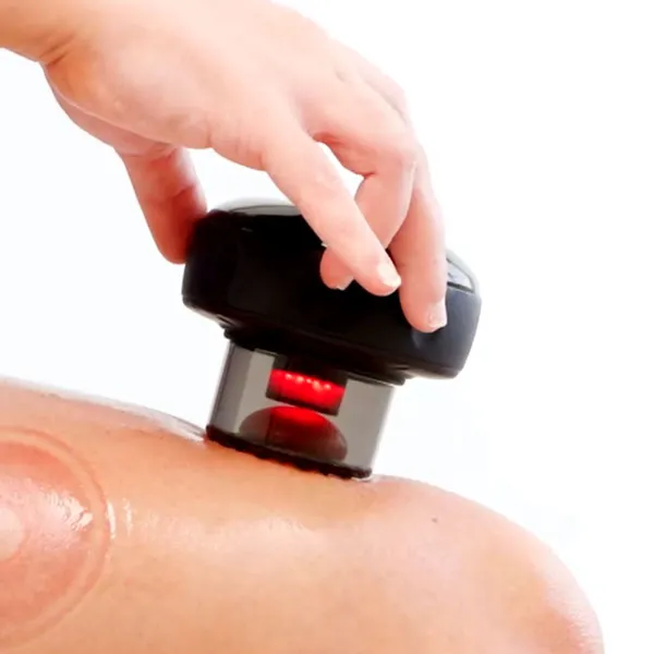 Revomadic cupping revolution system